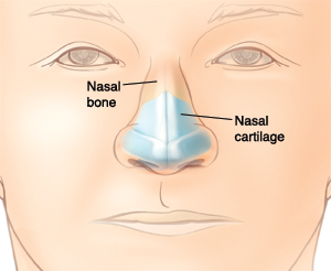 Face-on view of nose with location of nasal cartilage.