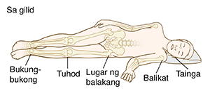 Balangkas ng taong nakahigang patagilid na may mga butong nakikita. Mga punto ng presyon: Tainga, balikat, bahagi ng balakang, mga tuhod, bukung-bukong.