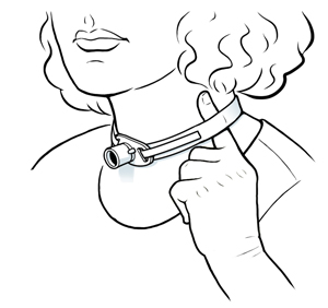 Close-up of neck with trach tube and one finger under ties.