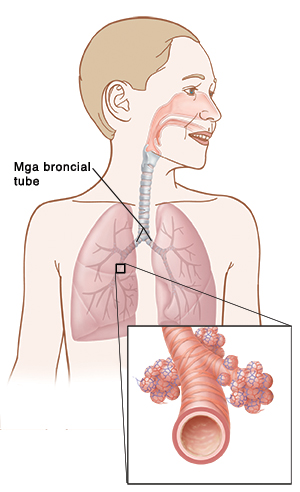Mga broncial tube