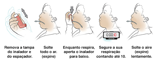 Cinco passos como usar um inalador sem espaçador.