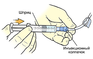 Крупный план рук, использующих шприц для введения раствора в инъекционный колпачок катетера.